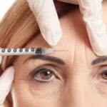 Anti Wrinkle Treatments Explained For Mature Women