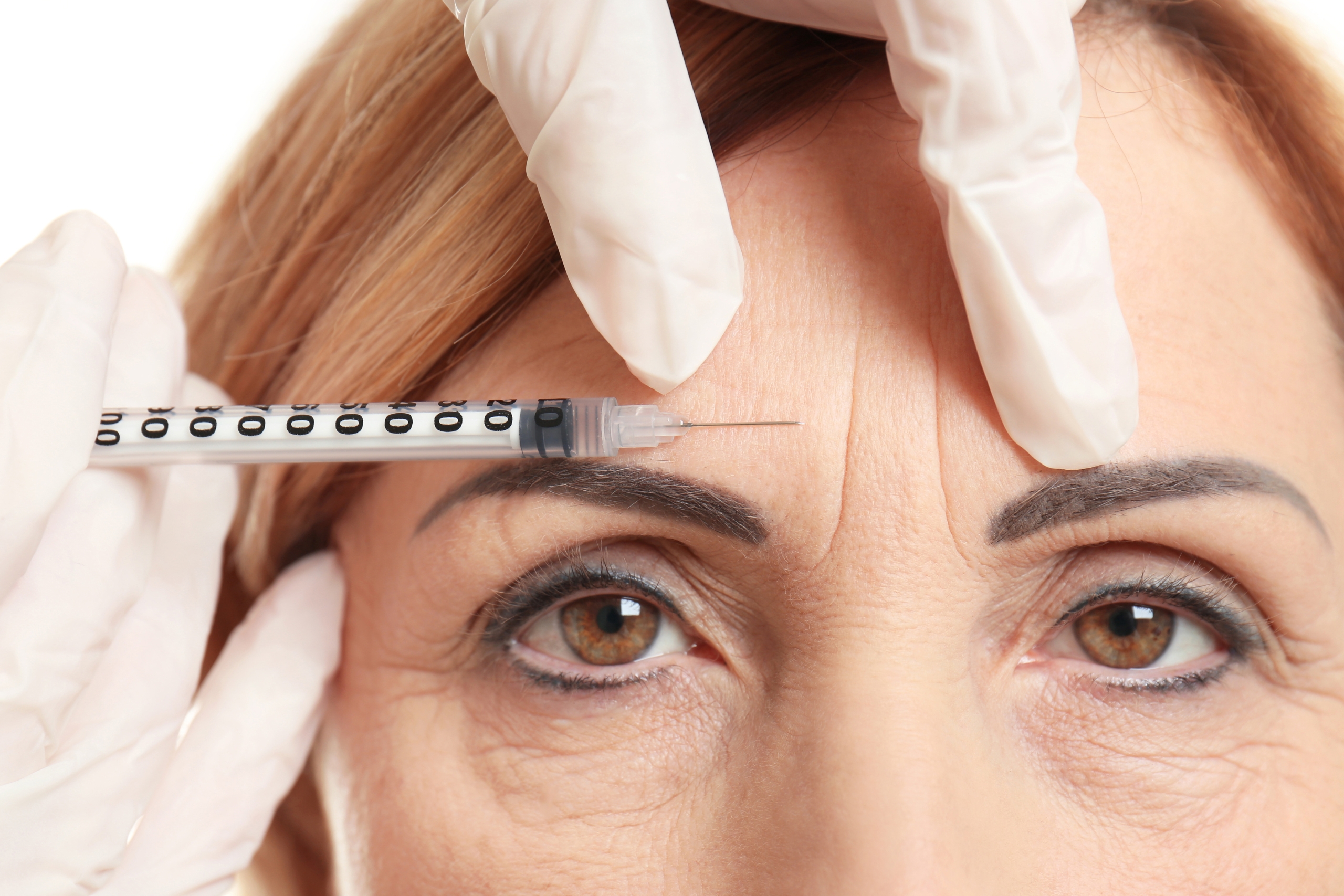 Anti Wrinkle Treatments Explained For Mature Women