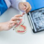 Why It Is Some Sort Of Good Idea To Have Dental Implants In Another Country