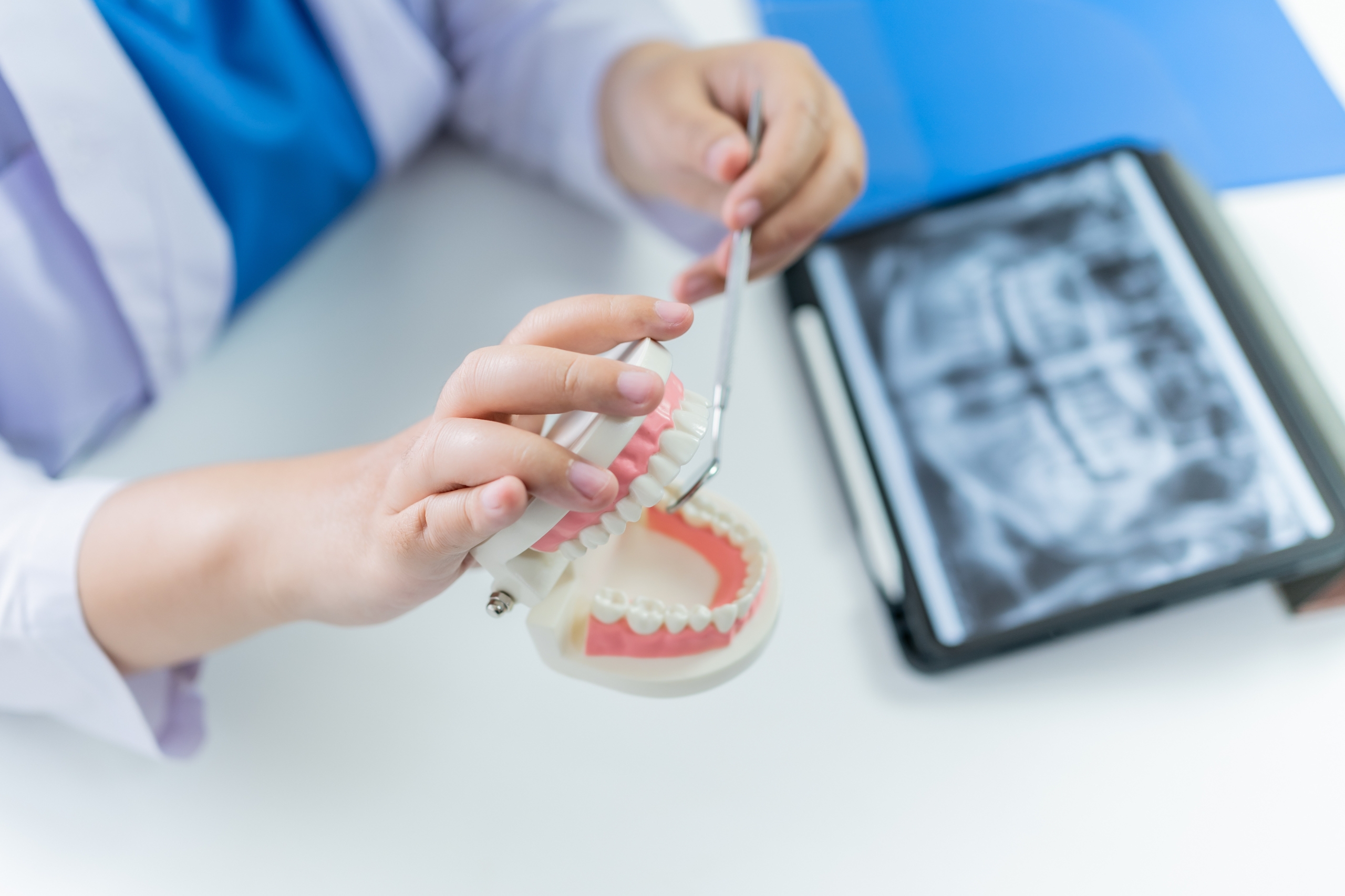 Why It Is Some Sort Of Good Idea To Have Dental Implants In Another Country